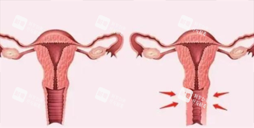 3D生物束帶緊縮術(shù)對比圖