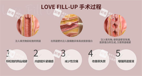 韓國信所愛女性醫(yī)院陰道注射