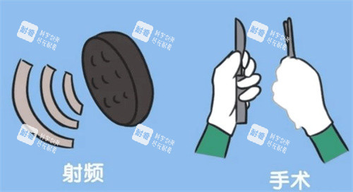 陰道緊縮有射頻和手術(shù)多種方式