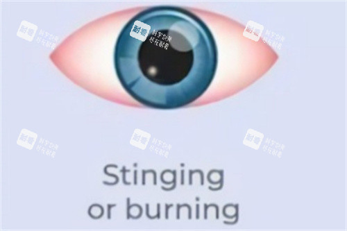 眼睛刺痛或燃燒