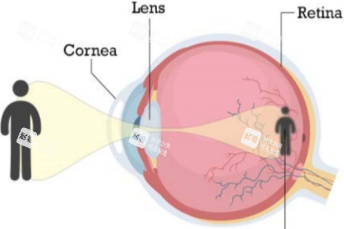 近視視物示意圖