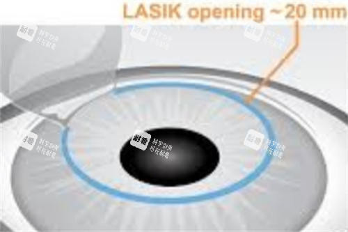 半飛秒制瓣示意圖 半飛秒制瓣示意圖