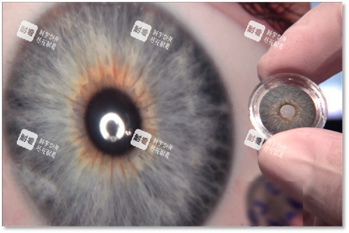 人工虹膜晶體實物 人工虹膜晶體實物