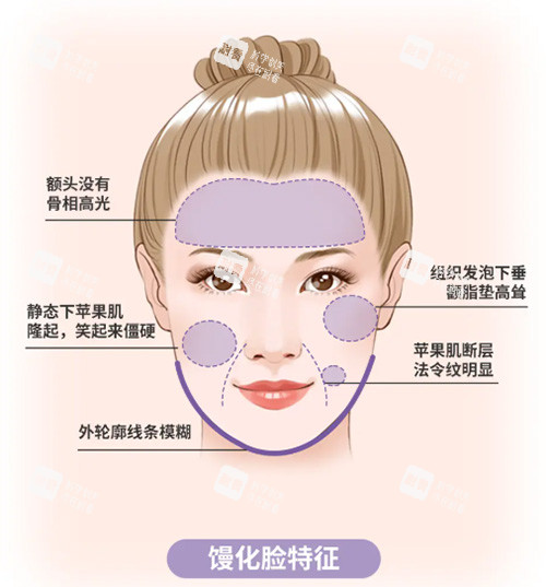 饅化臉怎么辦 饅化臉怎么辦