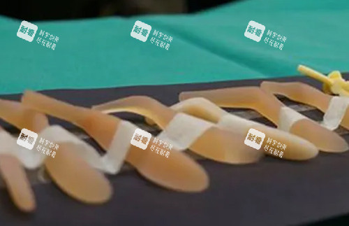 硅膠隆鼻假體照片