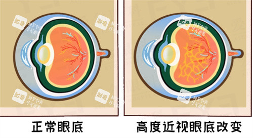 眼底視力呈現(xiàn)