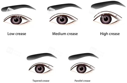 洛陽(yáng)割雙眼皮哪家強(qiáng)？孔繁榮/華美/締萊美等7家醫(yī)院實(shí)力對(duì)比