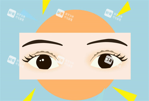 雙眼皮手術(shù)注意事項