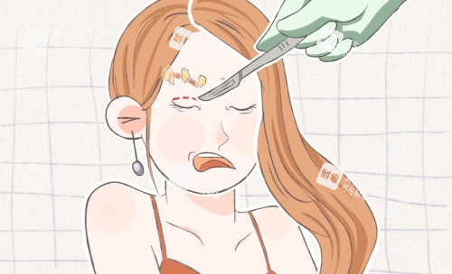 拉雙眼皮示意圖 拉雙眼皮示意圖