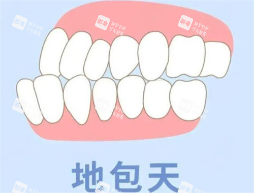 地包天動(dòng)畫展示圖