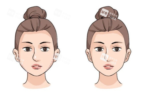 面部饅化修復(fù)卡通對(duì)比圖