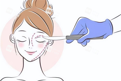 雙眼皮手術(shù)設(shè)計(jì)