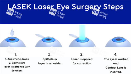 近視手術(shù)流程圖
