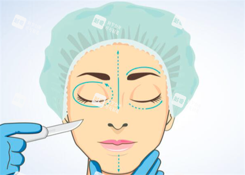 雙眼皮手術(shù)方案設(shè)計