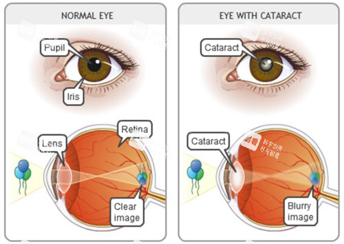 晶體置換晶體和眼睛的表現(xiàn)