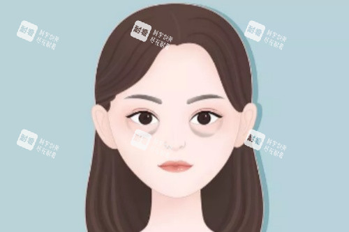 眼袋卡通圖展示