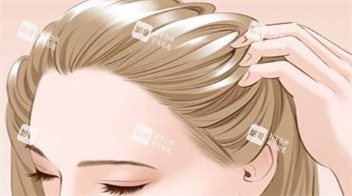 發(fā)際線后遺 發(fā)際線后遺