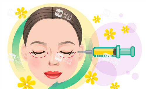 面部抽脂 面部抽脂