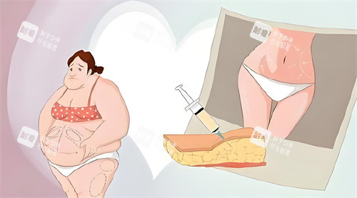 抽脂手術前后對比動畫圖 抽脂手術前后對比動畫圖