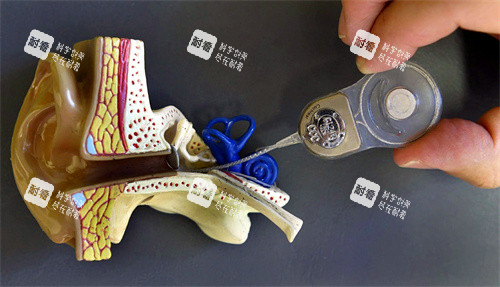 人工耳蝸和耳朵模型