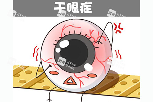 干眼癥卡通圖展示