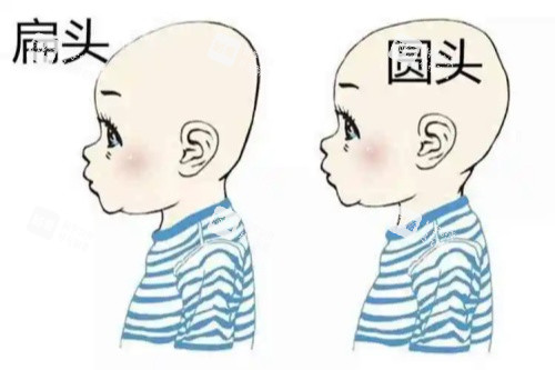圓頭、扁頭對比圖