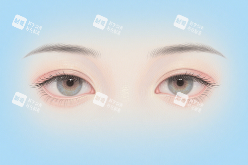 雙眼皮圖片 雙眼皮圖片