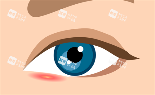 雙眼皮疤痕 雙眼皮疤痕