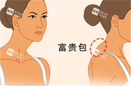 富貴包所在位置圖解