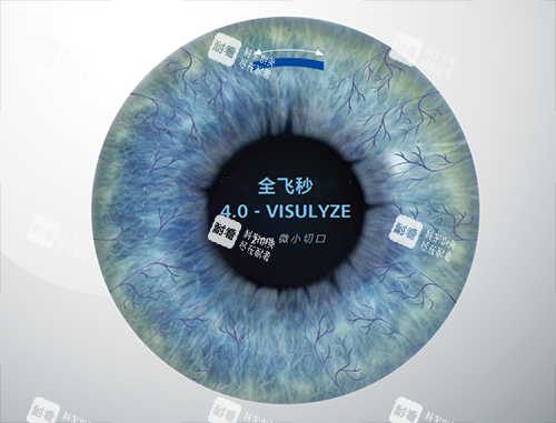 蔡司全飛秒4.0 蔡司全飛秒4.0