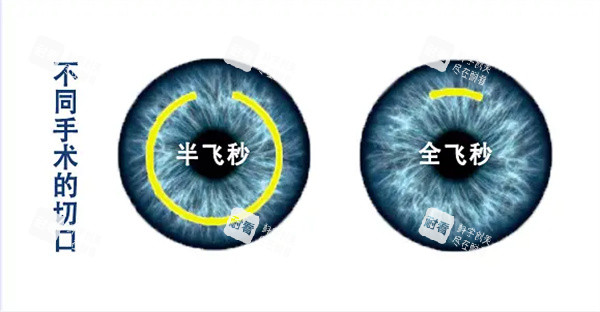 半飛秒和全飛秒?yún)^(qū)別 半飛秒和全飛秒?yún)^(qū)別