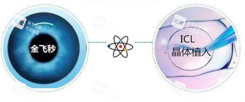 全飛秒和晶體植入 全飛秒和晶體植入