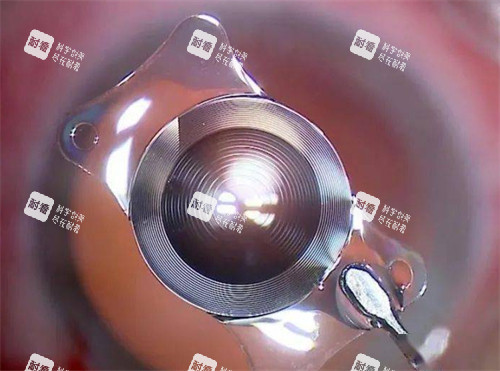 白內(nèi)障晶體展示