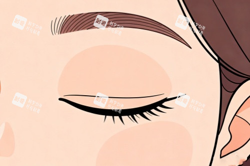 雙眼皮卡通圖 雙眼皮卡通圖