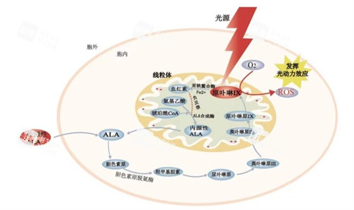 光動力治療黃斑眼病原理圖解