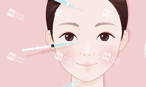 注射美容的部位示意圖 注射美容的部位示意圖