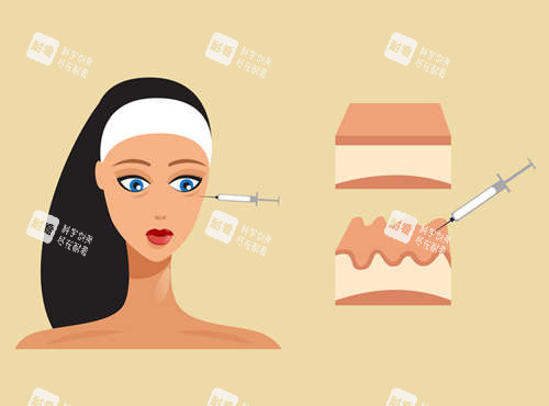 注射美容圖示 注射美容圖示
