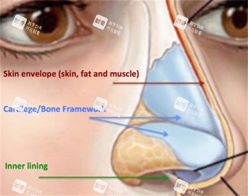 長鼻修復(fù)矯正對比