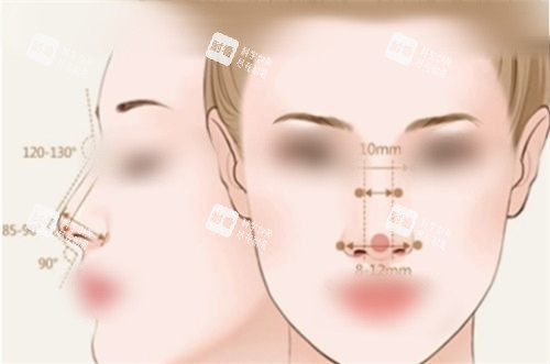 隆鼻后正面?zhèn)让嬲故緢D