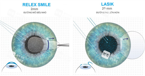 全飛秒跟半飛秒對比