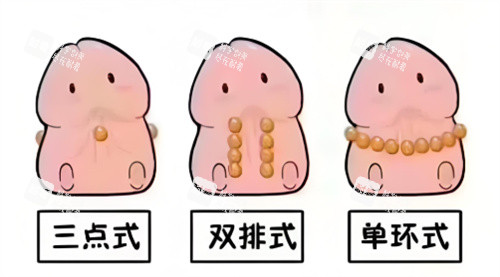 入珠手術(shù)動(dòng)畫(huà)2 入珠手術(shù)動(dòng)畫(huà)2