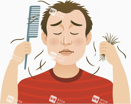 脫發(fā)示意圖