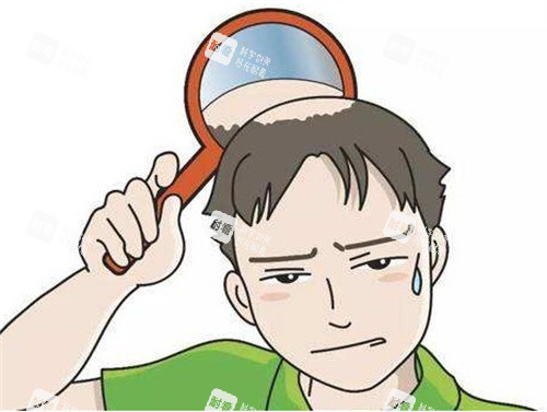 脂溢性脫發(fā)造成的困擾