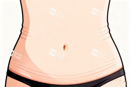 腹壁成型術卡通圖