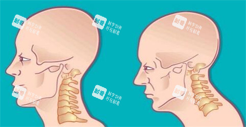 脖子長出富貴包卡通照片圖 脖子長出富貴包卡通照片圖