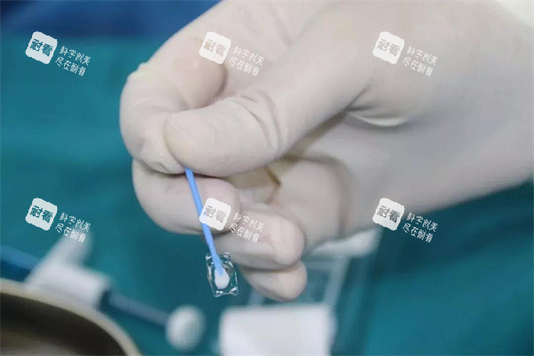 icl人工晶體真實圖