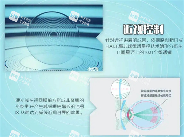 近視控制原理圖解 近視控制原理圖解