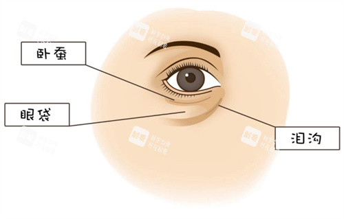 眼周問(wèn)題圖