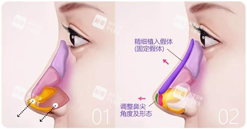 鼻綜合示意圖 鼻綜合示意圖