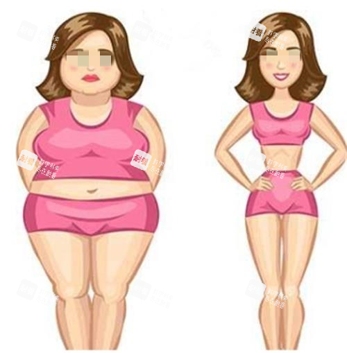 吸脂手術(shù)對(duì)比圖 吸脂手術(shù)對(duì)比圖